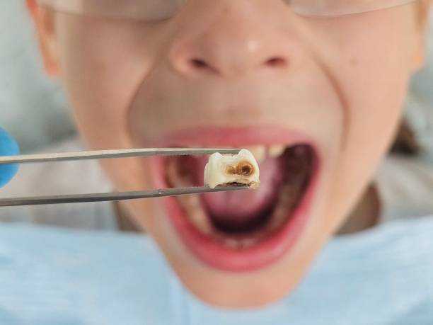 Best Pediatric Emergency Dentist in Menasha, WI